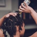 Discover the Top 5 Scalp Concerns and How to Treat Them Effectively