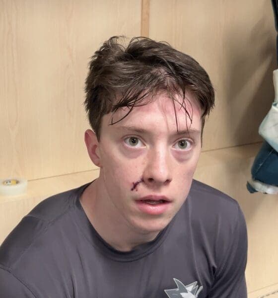 Graf Opens Up About Injury Struggles and Bubble Life Ahead of Game