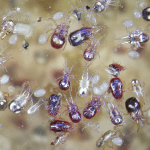 Woman Discovers Body Infested With Parasites After Decade of Eating Raw Pork