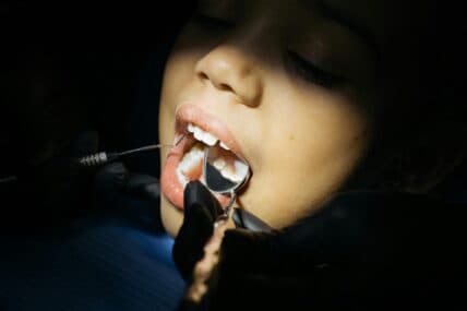 Is Fluoride Bad for You? RFK Jr. Wants It Out of Our Drinking Water