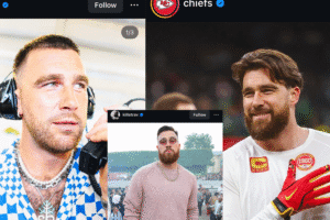 Travis Kelce's Hair Transformation Sparks Speculation About a Transplant