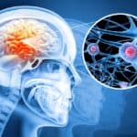 26-Year-Old Man Uncovers Early Signs of Inoperable Brain Tumor