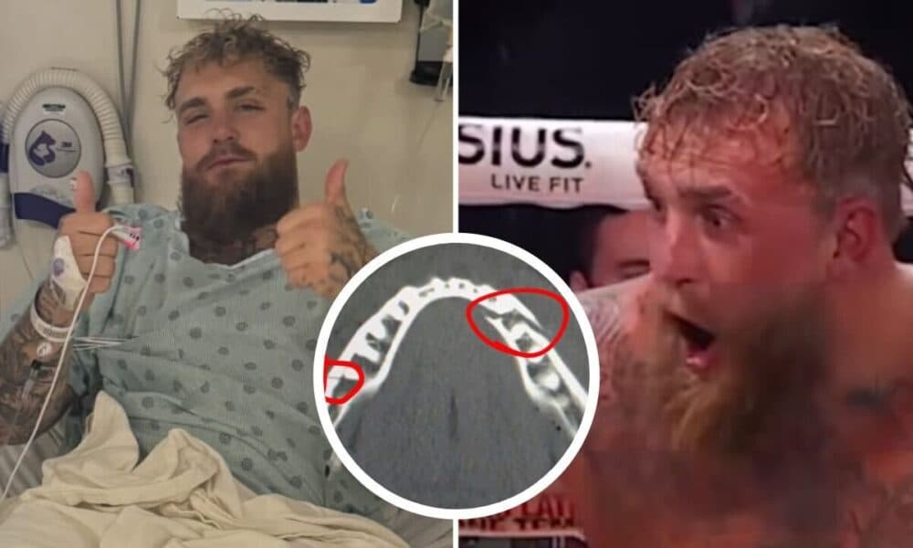 Jake Paul Faces Major Setback After Double Jaw Break in Heavyweight Fight