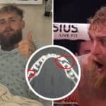 Jake Paul Faces Major Setback After Double Jaw Break in Heavyweight Fight
