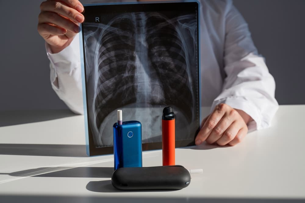 Teen's Lung Damage from Daily Vaping Raises Alarming Health Concerns