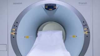 AI Breakthrough: Ezra's New Tool Revolutionizes Cancer Detection Methods